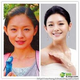 变性整容明星网红有哪些,变性整容明星网红的崛起与影响力